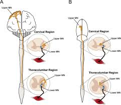 Enjoy the videos and music you love, upload original content, and share it all with friends, family, and the world on youtube. Assessing Rat Forelimb And Hindlimb Motor Unit Connectivity As Objective And Robust Biomarkers Of Spinal Motor Neuron Function Scientific Reports