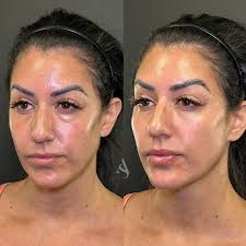 Alecia Baker FNP-C, CANS