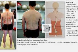 Image result for vyhřezlá ploténka