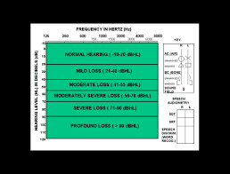 audiogram boston childrens hospital