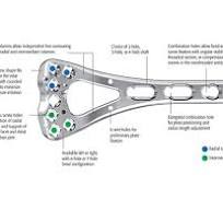 Variable Angle LCP Distal Radius System 2.4