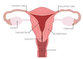 (the sarcoma is cancer that starts in muscle cells of the uterus.) in the past, cs was considered a different type of uterine cancer called uterine sarcoma (see below), but doctors now believe that cs is an endometrial carcinoma that's so abnormal it no longer looks much like the cells it came from (it's poorly differentiated). Information On Womb Cancer Peaches Trust