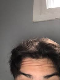 Thanks for reading 7 most stunning short wavy hairstyles. So I Want To Part My Hair Down The Middle And Have Both Sides Do What The Right Is Doing But The Left Isn T Listening How Do I Change This Malehairadvice