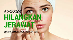 Orang yang sudah berkahwin, malahan sudah ada anak masih lagi mukanya dihinggapi jerawat. Anith Nadirah Ibu Cantik Anak Sihat 5 Petua Hilangkan Jerawat Dengan Cepat Secara Semulajadi