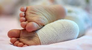 Ligaments can be injured when too much force is used to them and when it is moved beyond its normal range or motion. Sprains And Strains Babycenter