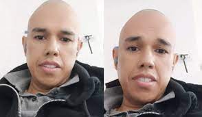 Diego Guauque recibe triste noticia en medio de su lucha contra el cáncer:  “Descansa en paz, hermanito” - Semana