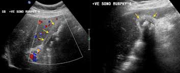 Image result for Murphy Sign