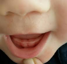 Dadurch, dass schon ab der geburt 20 kleine milchzähne nur darauf warten, durchzubrechen, gibt es tatsächlich kinder, die schon sehr bald erste zähne bekommen: Kommt Hier Der Erste Zahn Forum Fur Oktober 2016 Mamis