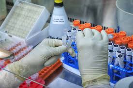 Covid, cosa sappiamo della variante delta che preoccupa il regno unito. Coronavirus Primeiro Caso Da Variante Indiana E Confirmado No Parana Agencia Estadual De Noticias