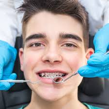 Straight Smiles Orthodontics