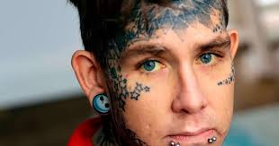 Huddersfield barman told to take laxatives after his stomach balloons