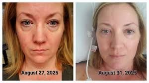 Experienced breast revision surgeon in SWFL with pig skin expertise