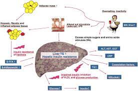 Nutrients Free Full Text Nutritional Modulation Of Non Alcoholic Fatty Liver Disease And Insulin Resistance