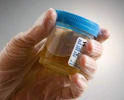 Dec 26, 2015 · minum ketum kosong pun sangkut ketamine skg. Afia Flex Kantoi Urine Test Sebab Minum Ketum Facebook