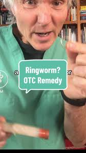 Ringworm in Pets: Effective OTC Home Remedies