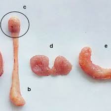 Image result for Synaptolepis alternifolia