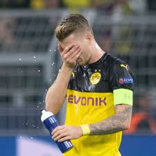 Warum haben männer gegenüber frauen mit kurzen haare eine so starke abneigung? Borussia Dortmund Fc Barcelona Champions League Reus Ubt Trotz Toller Leistung Des Bvb Selbstkritik Fussball