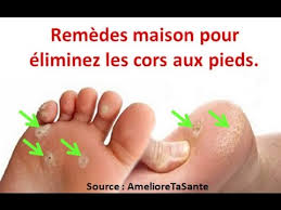 Les cors ne disparaissent pas spontanément et d'autres peuvent apparaître sur de nouvelles zones d'appui. Comment Soigner Les Cors Aux Pieds