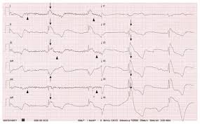 Image result for J Wave