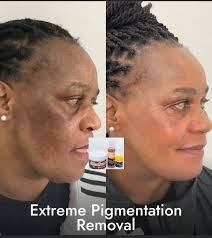 Hi Store Ermelo Oppisite Dunlop Tyres 27 Murray street Ermelo Come and  check out our MARKED DOWN STOCK