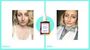 In this article, we outline what many surgery patients who use cbd want to know. Cannabis Derived Oil Moisturizers For Dry And Wrinkly Skin