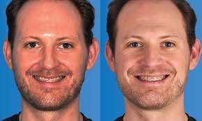 Ryan Jaw's Instagram, Twitter & Facebook