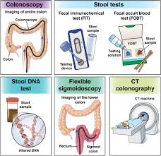 Image result for Screening Test