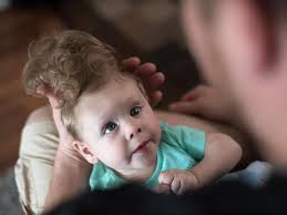 Baby born with brain outside his skull amazes parents, doctors