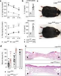 Check spelling or type a new query. Restoration Of The Healing Microenvironment In Diabetic Wounds With Matrix Binding Il 1 Receptor Antagonist Communications Biology