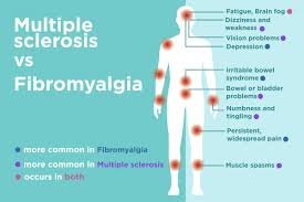 Fibromyalgia Vs Multiple Sclerosis Ms Differences In