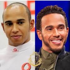 Les Nienfaits de la Vitamine B12 Pour les Cheveux