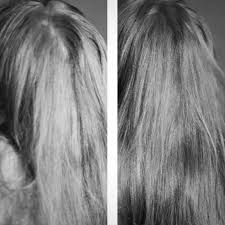 Wie Ich Mit Meinem Haarwirbel Klarkomme