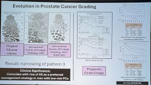 Image result for Prostate Cancer Histologic grading