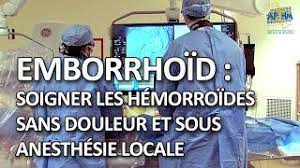 /fermé depuis plusieurs années, j'ai 3 à 4 fois par an, des poussées hémorroidaires très fortes et douloureuses. Emborrhoid Soigner Les Hemorroides Sans Douleur Et Sous Anesthesie Locale Youtube