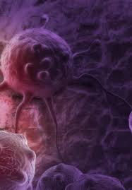 As a rule, the lower the number, the less the cancer has spread. Thyroid Cancers Considerations Classifications And Managements Intechopen