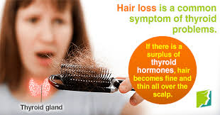 Thyroid conditions are seen in people with alopecia, which causes patchy hair loss. Managing Thyroid Problems And Hair Loss Menopause Now