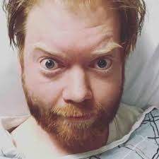 Fundraiser by Andy Still : Andys Broken Ribs Dilemma