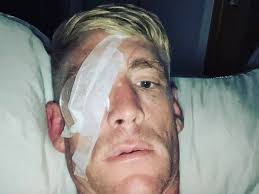 Welsh bareknuckle boxing legend almost blinded as he's forced to walk away  from fighting