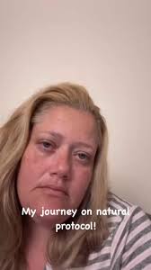 My journey with a natural protocol day two