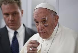 Francis (given name), including a list of people and fictional characters. Pope Francis Questions Trump S Pro Life Values Over Decision To End Daca National Catholic Reporter