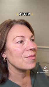 Leeza Edmundson Smith, Aesthetic Injector (@myinjectorleeza) • Facebook