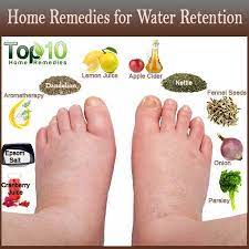 Pin On Lipedema