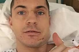 Battered Scott Quigg tweets picture after broken jaw surgery as he vows to  return from Frampton defeat