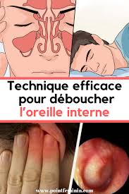 Comment Deboucher L Oreille Interne Ou Les Trompes D Eustache Deboucher Oreilles Interne Trompe Nettoyer Medical Health Massage