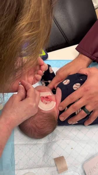 Ear Wells for Babies | TikTok