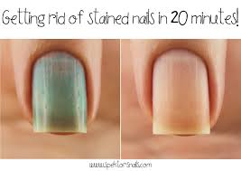We did not find results for: How To Remove Nail Polish Stains Nail Polish Stain Stained Nails Nail Polish