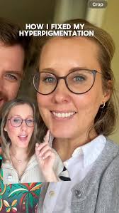 having acne prone, dry, scarred skin in your late thirties is SO  frustrating, and it’s honestly hard to look at old pictures of my skin.  here’s what has worked for me in the past year to fix my acne ...