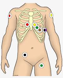 Entspricht die 12 kanal ekg anlegen der qualitätsstufe, die sie als kunde für diesen preis erwarten? Ekg Ableitung Unter Rettungsdienst Bedingungen 12 Kanal Ekg Kleben Free Transparent Png Download Pngkey