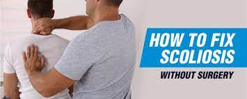 How To Fix Scoliosis Without Surgery