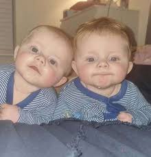 Deal mum's £4k bid to buy helmets for her twin sons who have severe flat  head syndrome